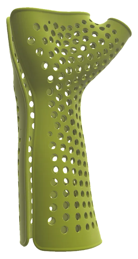 The brace demo's result: a ventilated wrist brace built on an arm scan, its hole pattern laid on a quad grid